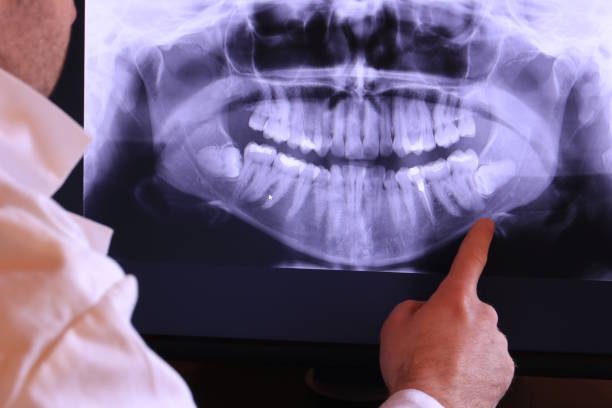 Best Emergency Treatment for Toothache in Lafayette, IN